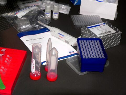 Lebensraum der Aale genetisch vorbestimmt – Besatz sinnlos? Aalforschung Labor